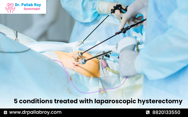 5 conditions treated with laparoscopic hysterectomy