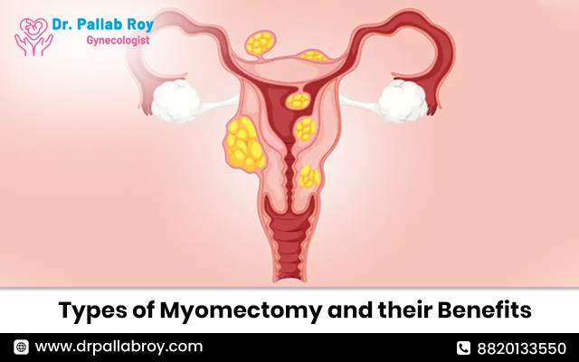 laparoscopic myomectomy steps