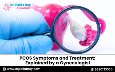 PCOS Symptoms and Treatment: Explained by a Gynecologist