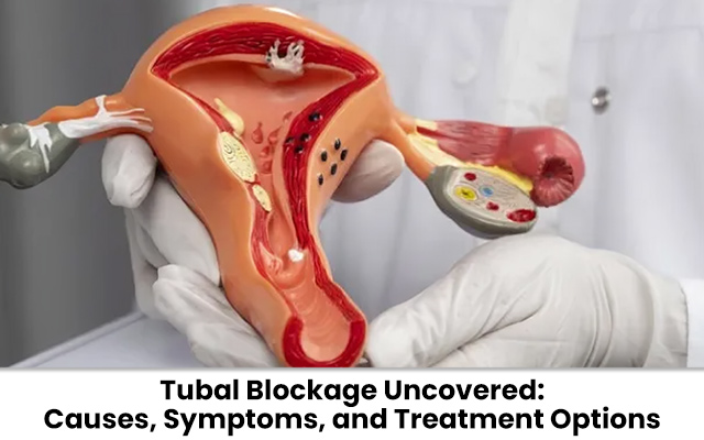 Tubal Blockage Uncovered: Causes, Symptoms, and Treatment Options