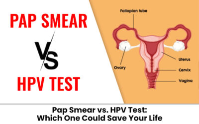 Pap Smear vs. HPV Test: Which One Could Save Your Life