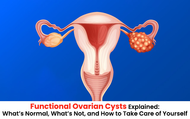 Female Infertility Treatment in Kolkata