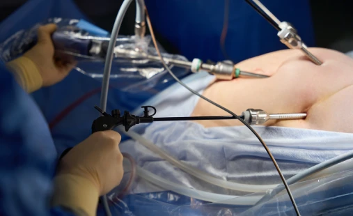 Endometriosis and ovarian surgery | Dr. Pallab Roy