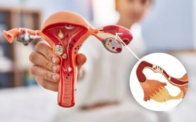 Blocked Fallopian Tubes & Female Infertility: Causes, Symptoms, Diagnosis & Treatment