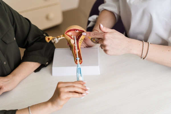 Ovarian Cyst Treatment
