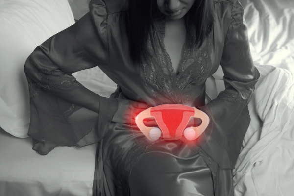 Ovarian Cyst Treatment